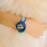 Swatch Flik Flak Skating Frenchie Quartz 34.75mm Watch FPSP075